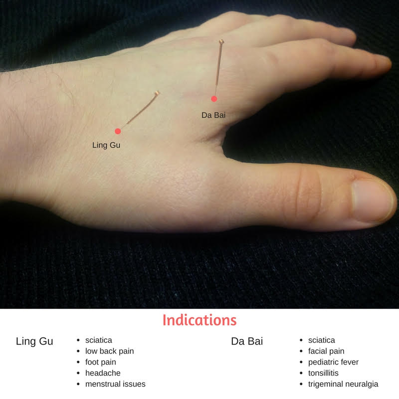 Showing two acupuncture points on the hand